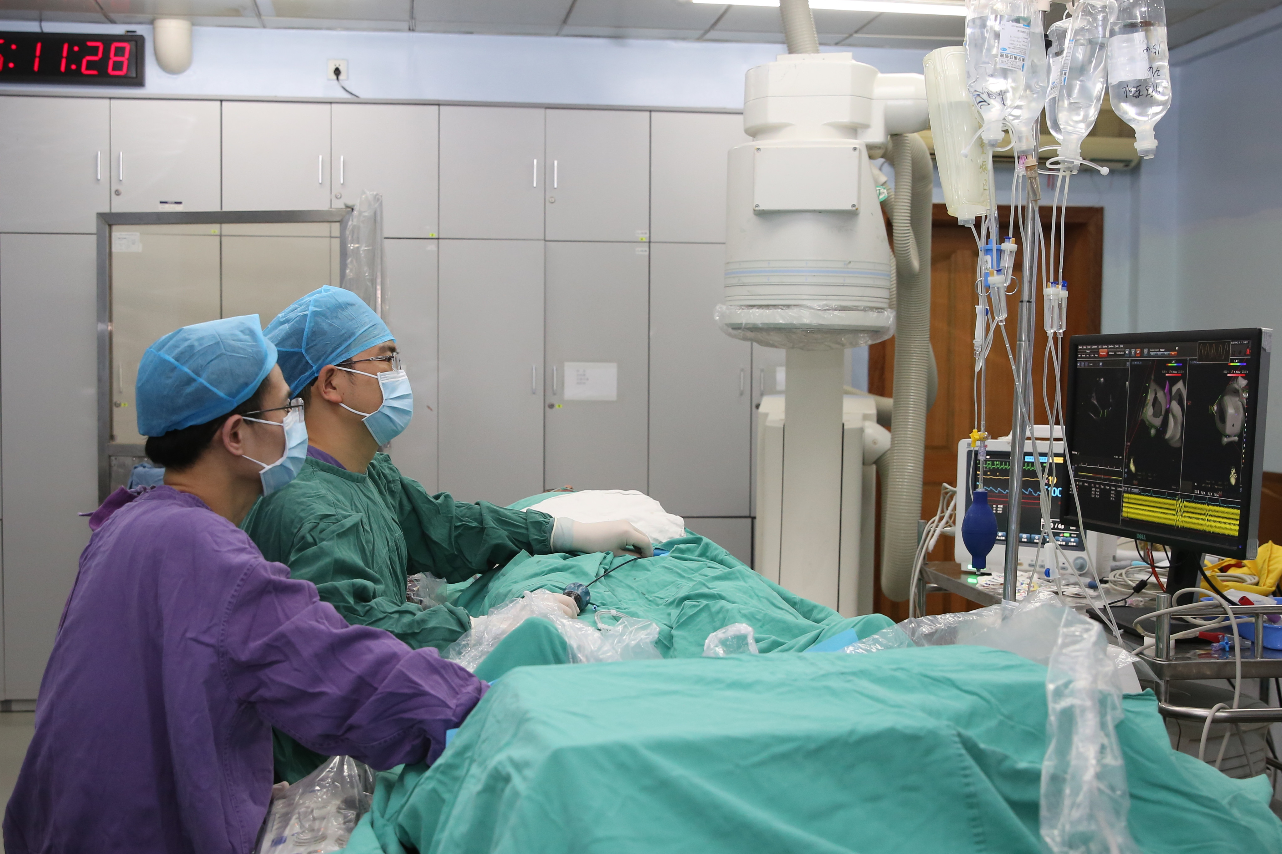 桂北首例：心腔内超声指导下的房颤射频消融在桂林人医完成