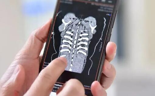 手机一扫，不再提着医学影像胶片到处跑，桂林人医云影像上线了