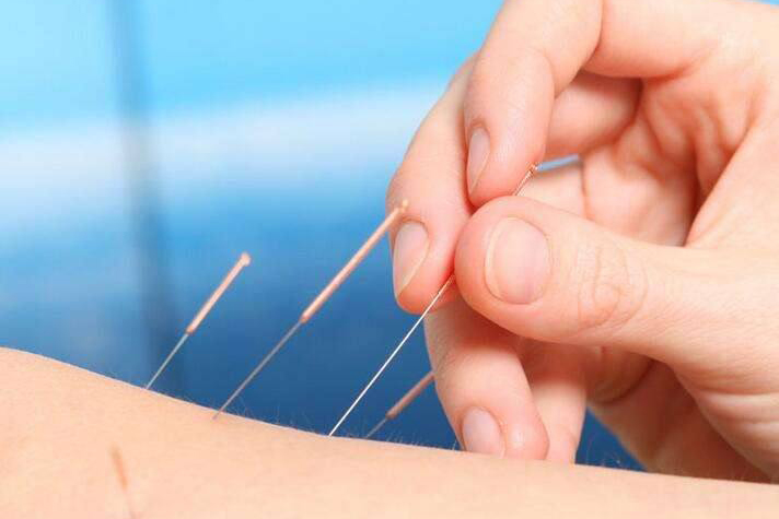 针灸推拿科简介